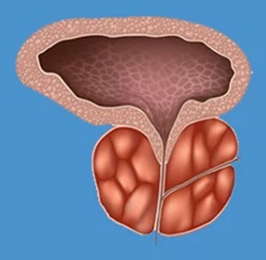 Charakteristické příznaky prostatitis