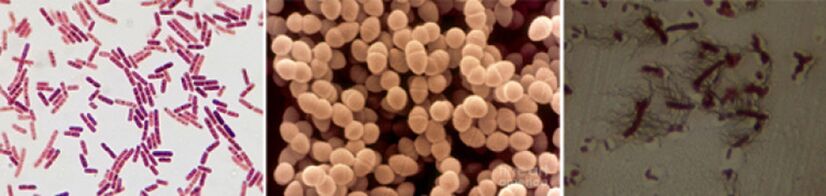 E. coli, fekální enterokoky a proteus jsou hlavními původci chronické bakteriální prostatitidy