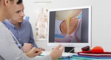 diagnostika prostatitidy u muže