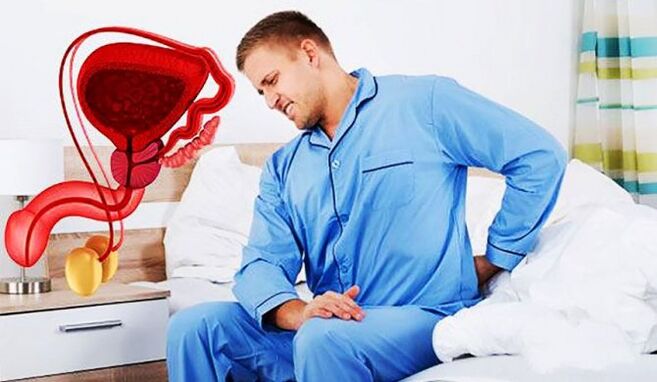 bolest dolní části zad způsobená prostatitidou